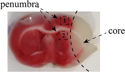 Treadmill Exercise Attenuates Cerebral Ischemia–Reperfusion Injury by Promoting Activation of M2 Microglia via Upregulation of Interleukin-4